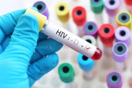 Chẩn đoán sớm nhiễm HIV cho trẻ dưới 18 tháng tuổi