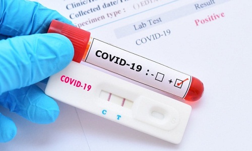 Cần biết: 16 loại test nhanh kháng nguyên SARS-CoV-2 được Bộ Y tế cấp phép