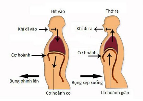 Ngày hen toàn cầu: Cùng tìm hiểu về bệnh Hen phế quản(Hen suyễn)