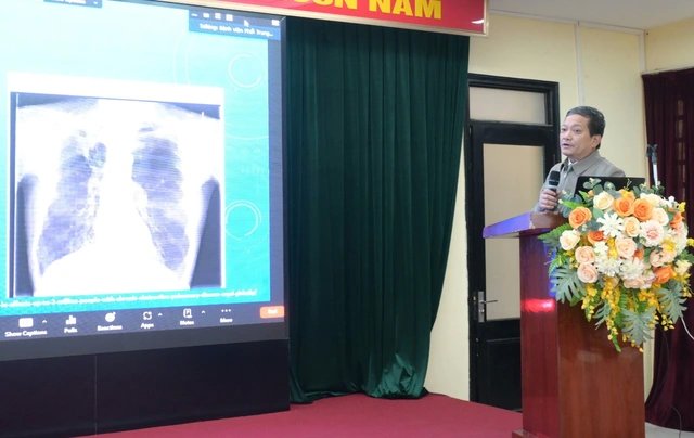 90% người mắc nấm phổi chưa được phát hiện