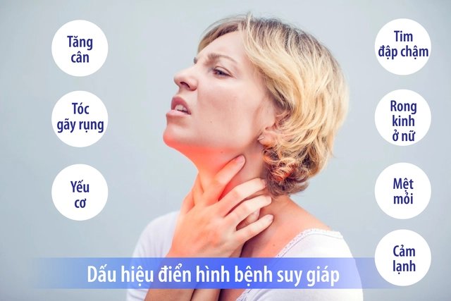 Nguyên nhân gây hội chứng suy giáp