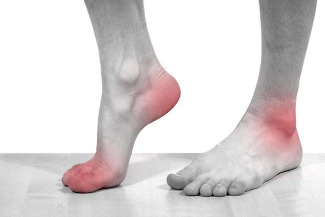 Gout: Nguyên nhân, triệu chứng và cách điều trị và phòng bệnh