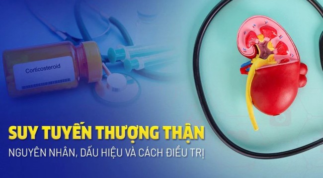 Uống thuốc chống viêm chữa đau lưng kéo dài, người phụ nữ béo bụng, da mỏng, bác sĩ cảnh báo bệnh suy tuyến thượng thận