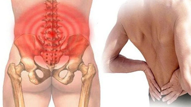 Nên làm gì khi bị đau cột sống thắt lưng?