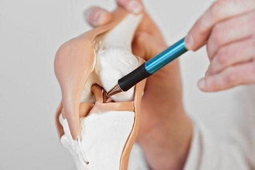 Chấn thương sụn chêm: Nguyên nhân, triệu chứng, điều trị và cách phòng bệnh
