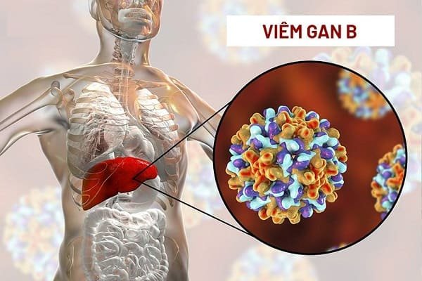 Nguy cơ suy gan nếu tự bỏ thuốc điều trị viêm gan B