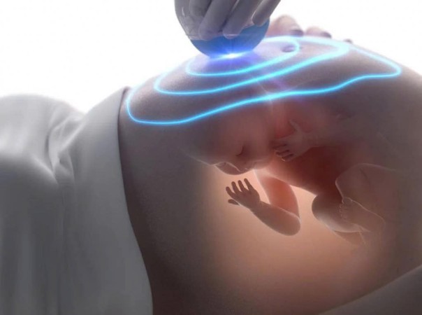 Hội chứng Noonan: Nguyên nhân, biểu hiện, cách điều trị và phòng bệnh