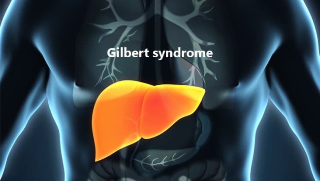Dinh dưỡng trong hội chứng Gilbert
