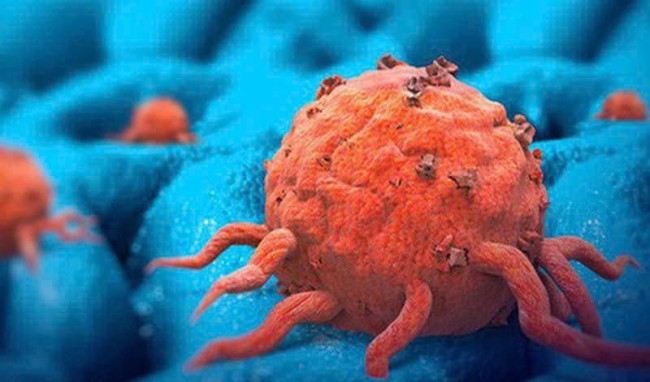 Thuốc điều trị Hội chứng Carcinoid