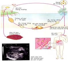 BỆNH SÁN LÁ GAN - CÓ LÂY KHÔNG VÀ LÂY QUA ĐƯỜNG NÀO